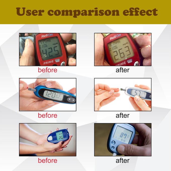Sugar Sentry Wristband – Glucose Guard Pro (Buy 1 Get 1 Free | 30% OFF)