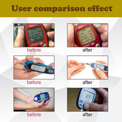 Sugar Sentry Wristband – Glucose Guard Pro (Buy 1 Get 1 Free | 30% OFF)